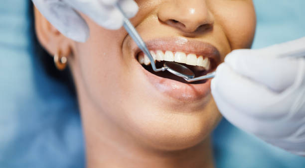 Best Chipped Tooth Repair Near Me  in Smithfield, VA