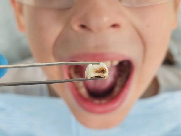 Best Tooth Infection Emergency Dentist  in Smithfield, VA